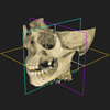 Perfekte Diagnostik: Was ist das Geheimnis des 3D CT?
