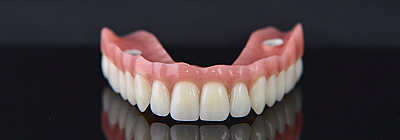 Zahnprothesen: Alles, was Sie wissen müssen