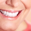 A fogászati implantátumra épülő leghatékonyabb fogpótlások