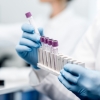 Corona oder Grippe? Der neue Kombi-PCR-Test schafft Klarheit!