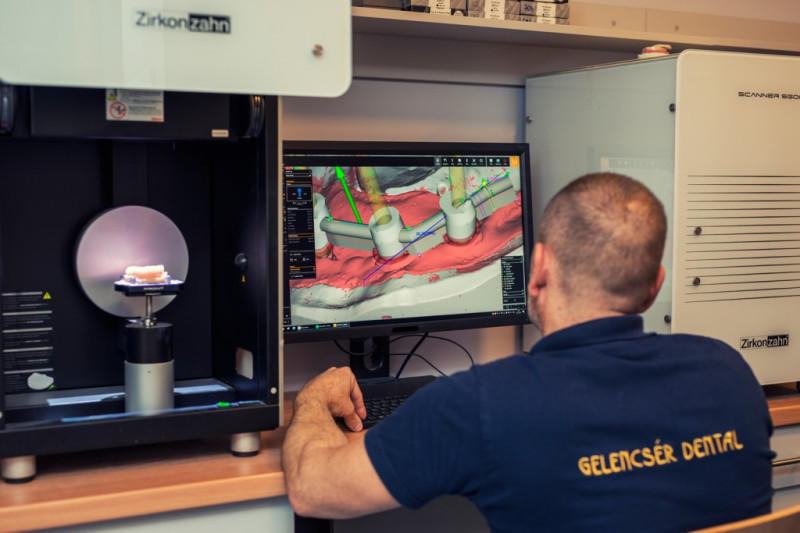 Herstellung eines perfekt funktionierenden Zahnersatzes Herstellung eines perfekt funktionierenden Zahnersatzes