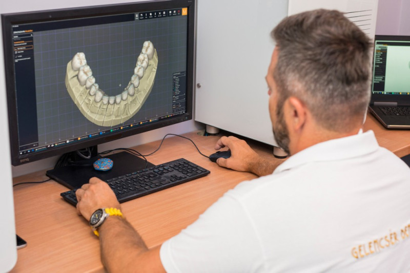 Erstellung langlebiger Kronen in unserem Labor