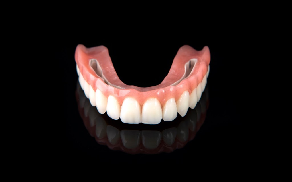 Oberkiefer erfahrungen klammerprothese Zahnersatz: Vorher