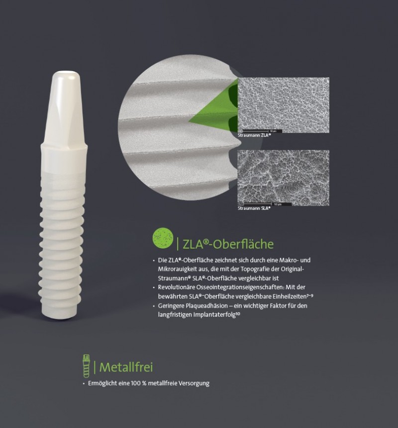 Straumann® PURE Ceramic Implantat: Metallfreies Implantatsystem Vom ...