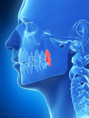 Weisheitszähne Weisheitszähne