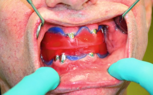 Registrierung der zentralen Relation