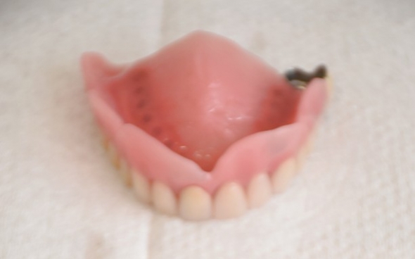 Basis vom fertigen Zahnersatz von oben